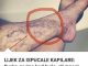 Svatko kod kuće ima lijek za popucale kapilare, ali mnogi ljudi to ne znaju! Svatko kod kuće ima lijek za popucale kapilare, ali mnogi ljudi to ne znaju! - featured image