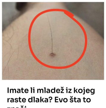 Evo šta tačno znači kada vam iz mladeža raste dlaka: Da li je to opasno, iznenadit ćete se Evo šta tačno znači kada vam iz mladeža raste dlaka: Da li je to opasno, iznenadit ćete se - featured image