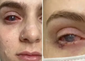 Popila tabletu protiv bolova koju uzimaju mnogi, a onda joj se život zauvijek promijenio Popila tabletu protiv bolova koju uzimaju mnogi, a onda joj se život zauvijek promijenio - featured image
