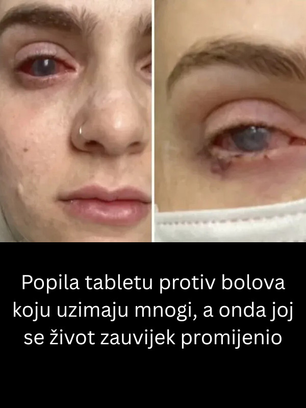 Popila tabletu protiv bolova koju uzimaju mnogi, a onda joj se život zauvijek promijenio - featured image Popila tabletu protiv bolova koju uzimaju mnogi, a onda joj se život zauvijek promijenio - featured image