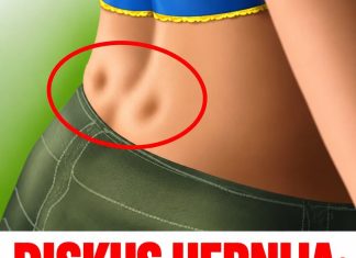 DISKUS HERNIJA: Ovaj DOMAĆI LIJEK potpuno OBNAVLJA KIČMU, JAČA JE I LIJEČI DISKUS HERNIJA: Ovaj DOMAĆI LIJEK potpuno OBNAVLJA KIČMU, JAČA JE I LIJEČI - featured image